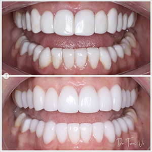 Cosmetic Dentist in Braselton