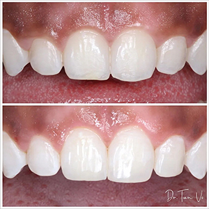 Braselton Dentist