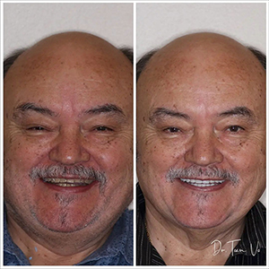 Dentist in Braselton