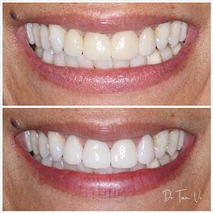 Cosmetic Dentist in Braselton